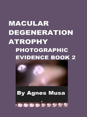 cover image of Macular Degeneration Atrophy, Photographic Evidence Book 2
